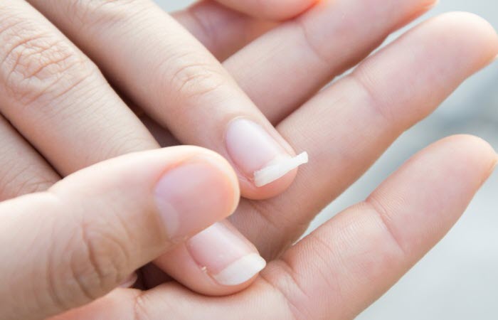 Broken Nails Remedy: The 4 Effective Tricks to Restoring Your Nails